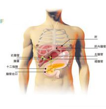 疾病分析 疾病分析